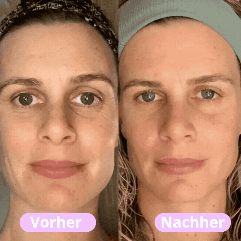 Flivit - Straffendes LED-Gesichtsmassagegerät